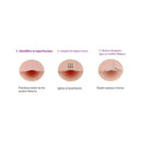 Pack 2 Cajas De Parches Para Granos Parches Para Acne 144und Acneica Día/noche